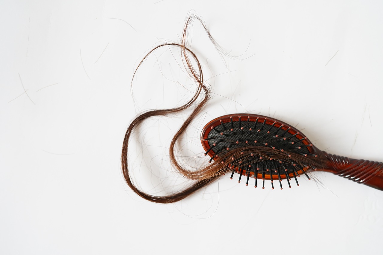 alopecia caída de cabello